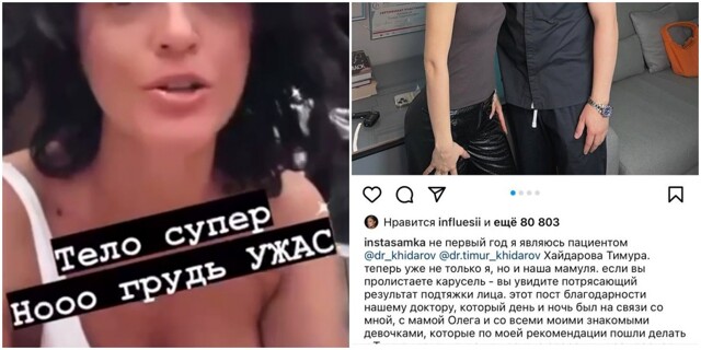 Звёздные пациентки "хирурга-кальянщика" Тимура Хайдарова пожаловались на его "кривые руки"