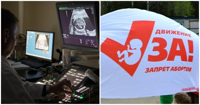 Первый российский регион официально запретил пропаганду абортов