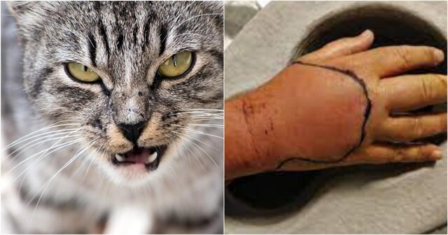 Кот укусил жителя Великобритании и он заразился неизвестной инфекцией