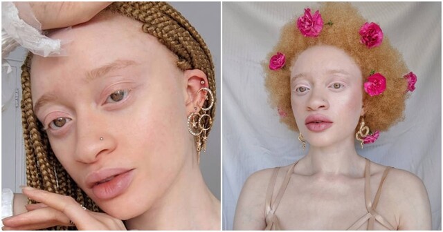 Необычные гены: западноафриканская модель с альбинизмом