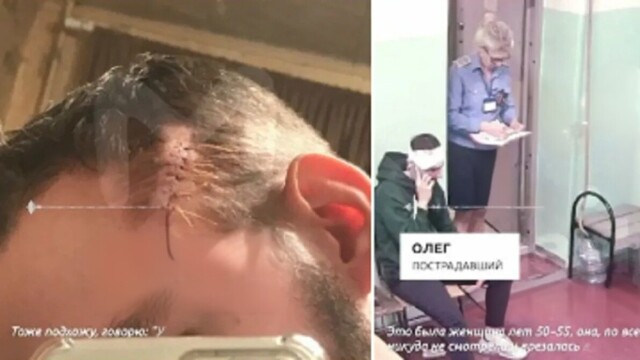 В Санкт-Петербурге женщина порезала канцелярским ножом лицо парню