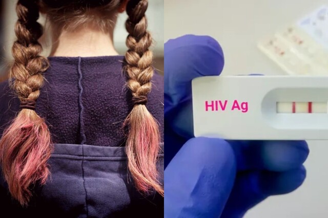 13-летняя ВИЧ-инфицированная школьница из Москвы сознательно заразила своего знакомого