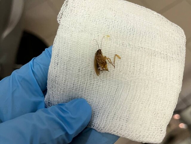 В Подмосковье из уха женщины достали живого таракана