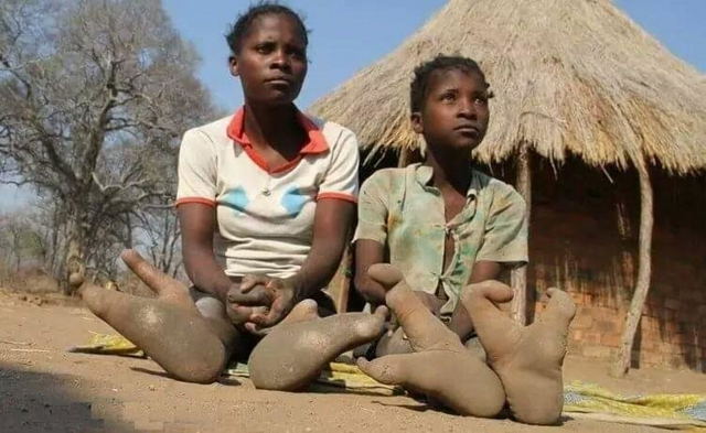 Люди-страусы с двумя пальцами: африканское племя Вадома