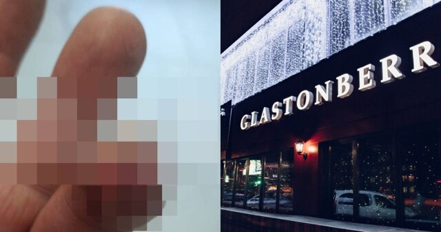В Москве пьяный посетитель клуба приставал к девушкам, а потом откусил охраннику часть пальца