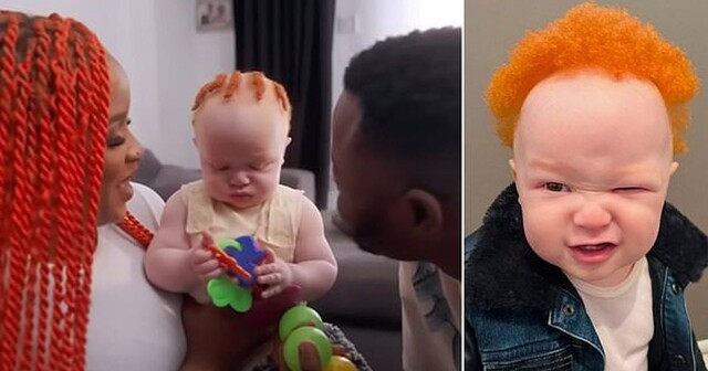 У чернокожих родителей получился ребёнок-альбинос с рыжими волосами