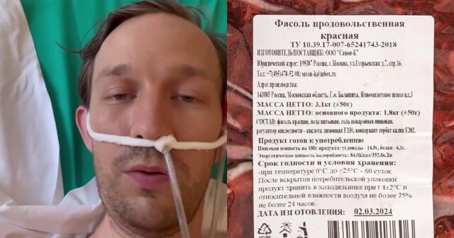География ботулизма в РФ увеличилась, заболевшие делятся своими буднями из инфекционных клиник