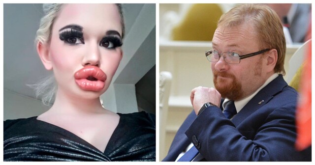 «Это всё уродство»: депутат Милонов призвал запретить женщинам бесконтрольно увеличивать губы