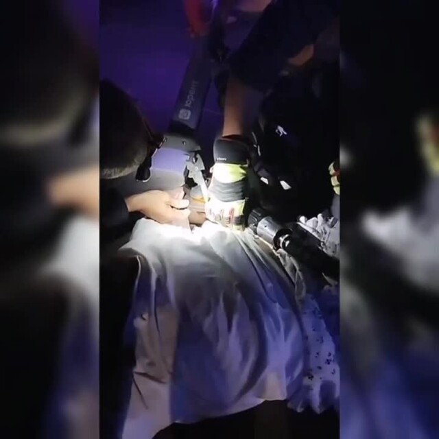 В Москве прооперировали 14-летнюю девочку, руку которой насквозь пробил стопор электросамоката⁠⁠