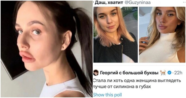 "Сделала свисток": в соцсетях обсуждают, красиво ли увеличивать губы