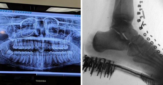 15 случаев, когда рентгеновские снимки показывали, что интересного можно увидеть внутри привычных вещей