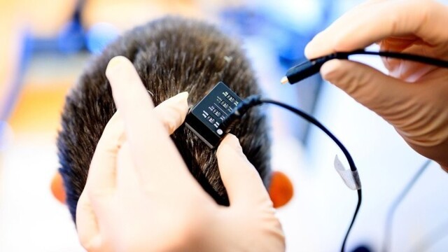 Ученые разработали мозговой имплант, который переводит мысли в речь почти мгновенно