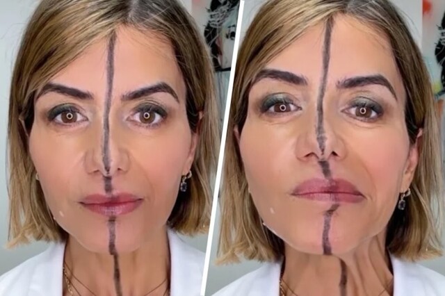 В США косметолог сделала инъекции ботокса в половину лица, чтобы показать его эффект
