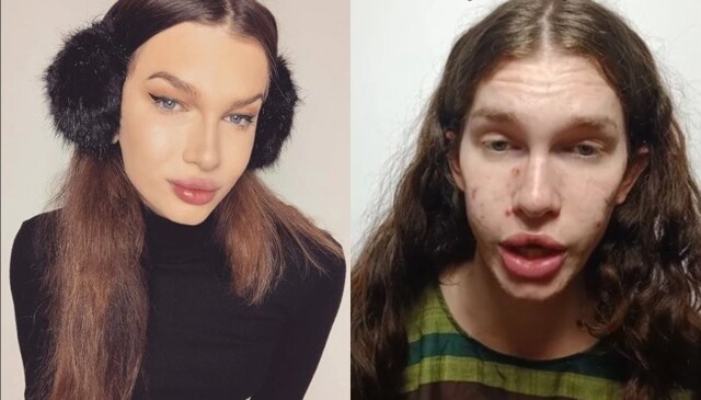 Женщина потратила $8 тысяч, чтобы выглядеть как кошка, но теперь сожалеет об этом