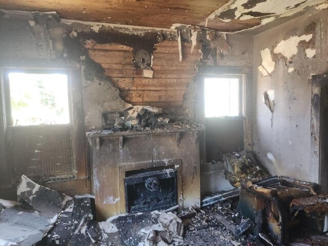 Мужчина спас собаку из пожара и потерял почти половину кожи