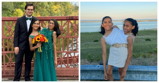 Одна из сиамских близняшек вышла замуж