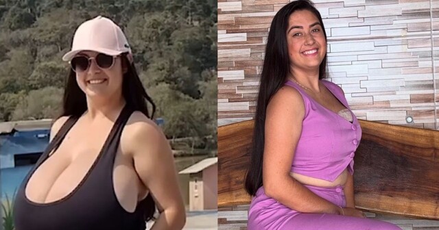 Грудь студентки ежемесячно увеличивалась на 750 граммов