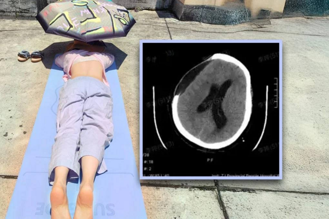 В Китае женщина впала в кому после «лечебного» загара