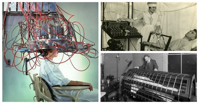 25 пугающих устройств и процедур прошлого, демонстрирующих прогресс современной медицины