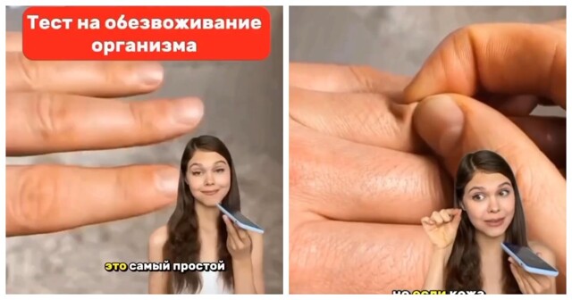 Девушка рассказала про простой тест на обезвоживание