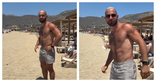 Избавление от лысины за пару секунд⁠⁠