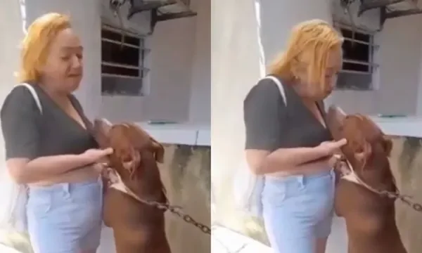 В Бразилии женщина потеряла губу после поцелуя с питбулем