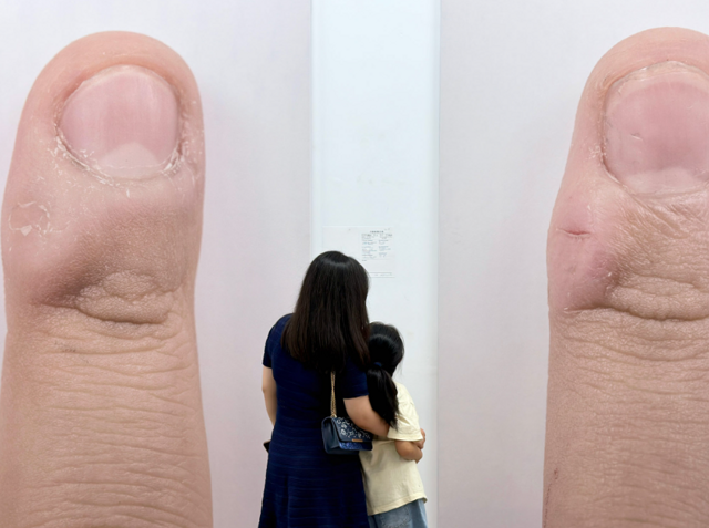 Фотографии мозолей китайских школьников – выставка о несчастье