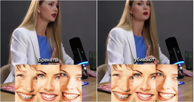Брекеты: мифы об опасностях и почему всё зависит от специалиста