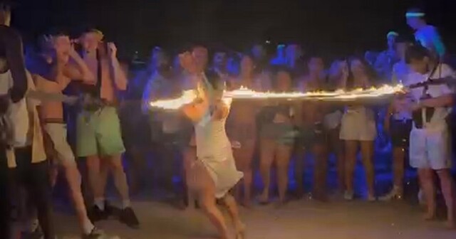 Прыжки через огненную скакалку закончились ожогами