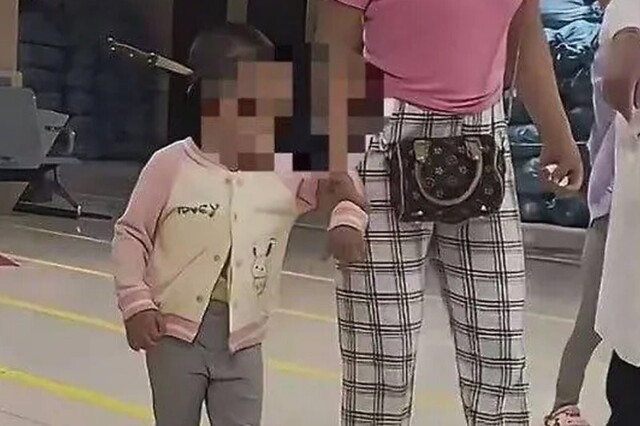 В Китае спасли трехлетнюю девочку с 15-сантиметровым ножом в голове