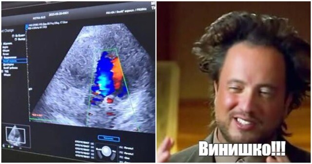 Пять бутылок вина вместо кардиолога: как житель Подмосковья лечил сердце