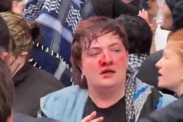 Инцидент в Берлине: полицейский ударил феминистку в нос