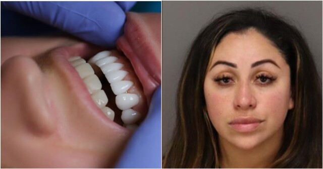 Зубы на клею: как аферистка во Флориде записалась в стоматологи