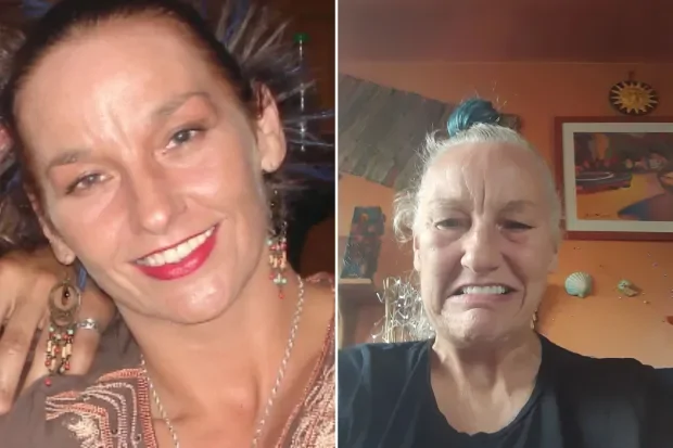 Женщина отдала все деньги на новые зубы и "постарела на 20 лет" за один день