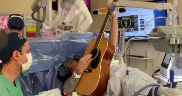 Мужчина играл на гитаре, пока ему удаляли опухоль мозга