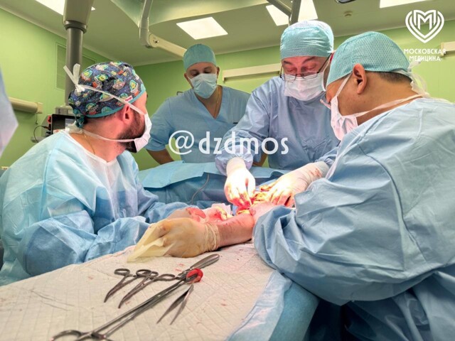 Прорыв в российской медицине: в Склифе пациенту пришили кисть от посмертного донора