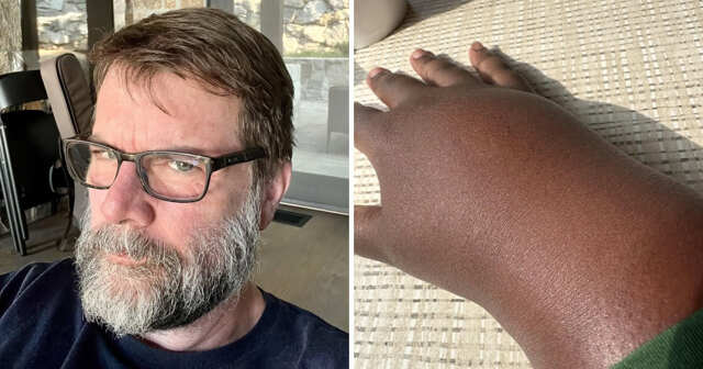 12 интересных случаев, когда с телом людей случилось что-то странное