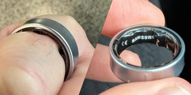 Мужчина чуть не потерял палец из-за умного кольца Samsung