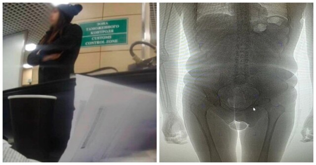 Латиноамериканка попыталась провезти в себе 250 граммов кокаина