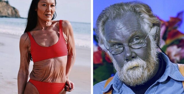 Люди, особенности тела которых делают их уникальными и непохожими на остальных