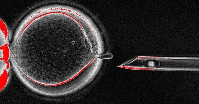 Учёные создали человеческие яйцеклетки из клеток кожи