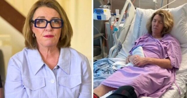 Австралиец сломал женщине рёбра за замечание о собаке