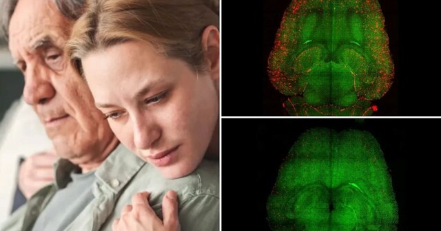 Нанотехнологии показали эффективность в лечении болезни Альцгеймера у мышей