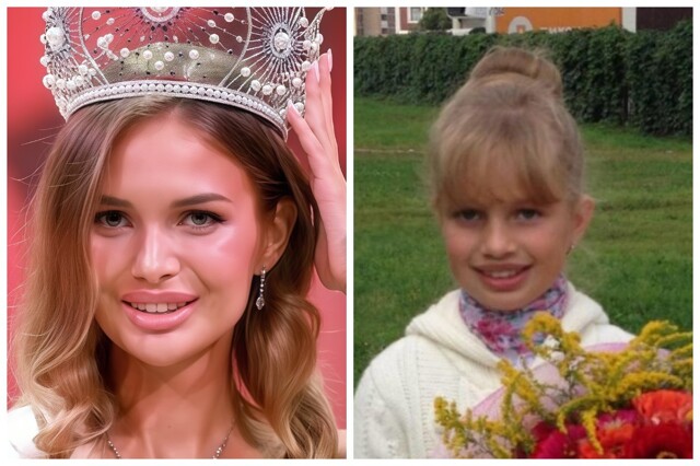 «Мисс Ботокс-2025»: победительница конкурса красоты показала детское фото, чтобы опровергнуть негативные комментарии