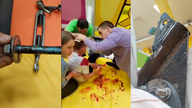 В Омске в развлекательном центре крепление тарзанки пробило голову ребенку