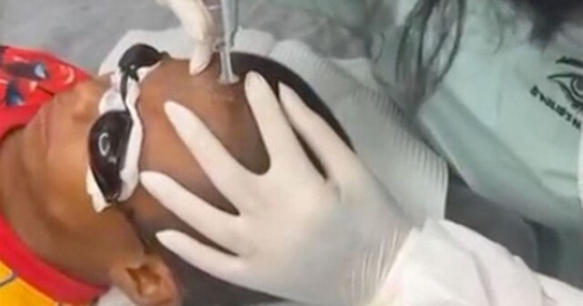 Хулиганы сделали оскорбительную татуировку на лбу мальчика