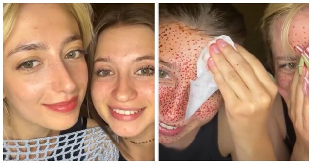 В погоне за естественной красотой: девушки нарисовали веснушки и пожалели