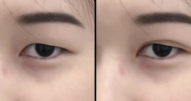 Как целая нация меняет лицо, чтобы устроиться на работу