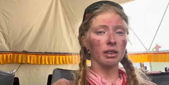 Девушка показала, чем обернулась попытка покорить вершину Эвереста