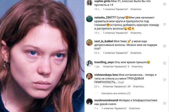 "Пришло наше время": девушки в знак протеста придумали новый тренд - круги и припухлости под глазами